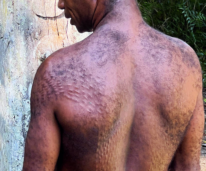 Crocodile Man Back Scars